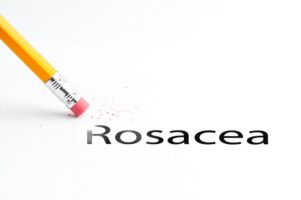 Home Health Care Berkeley Heights NJ - Help Your Elderly Relative Deal With Rosacea